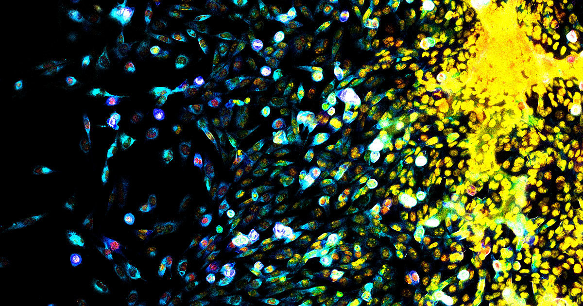 disruptive-insider-ibm-cancer-ai-open-source-road-to-singularity